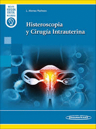 HISTEROSCOPIA Y CIRUGIA INTRAUTERINA