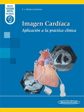 IMAGEN CARDIACA